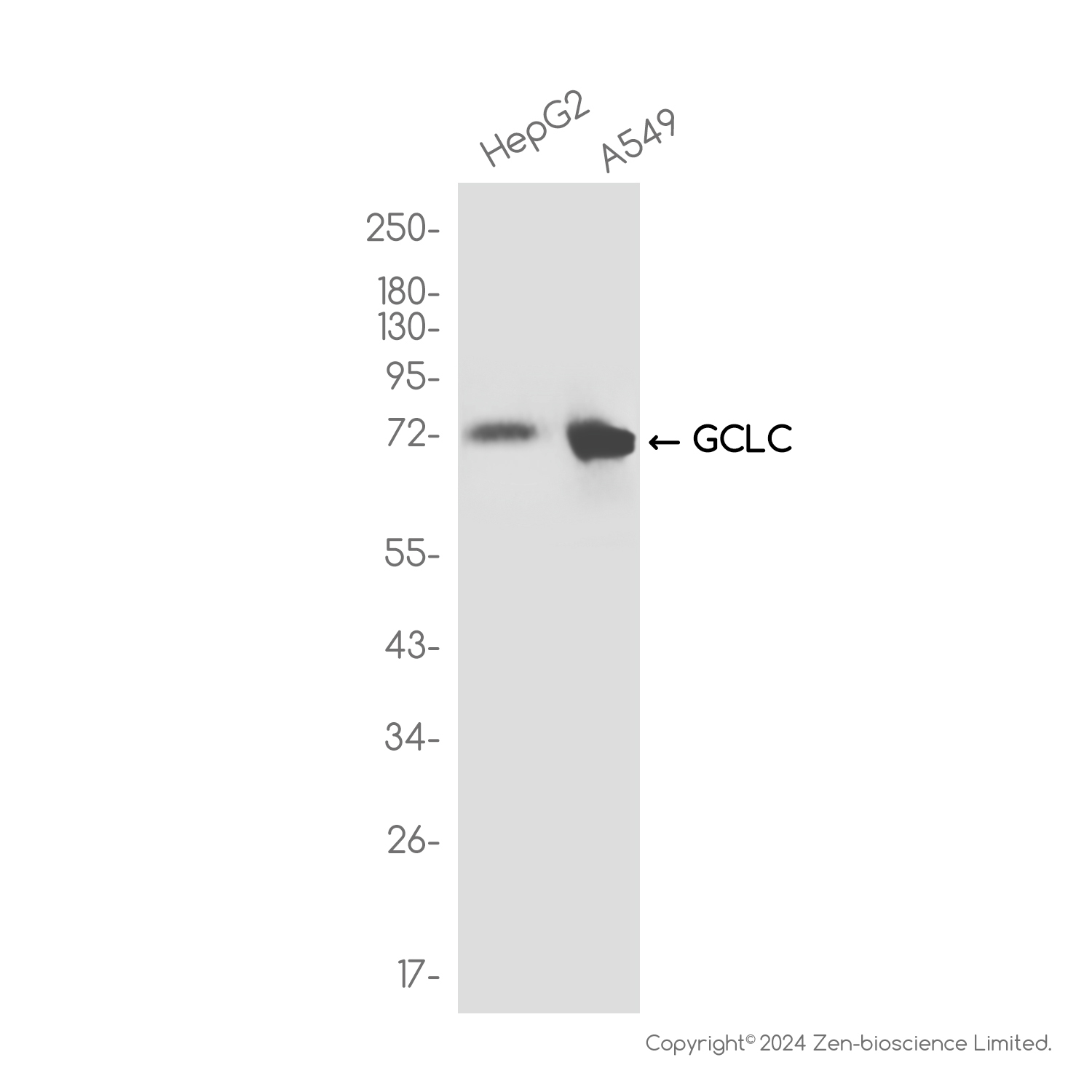 GCLC Rabbit mAb ABZ3809
