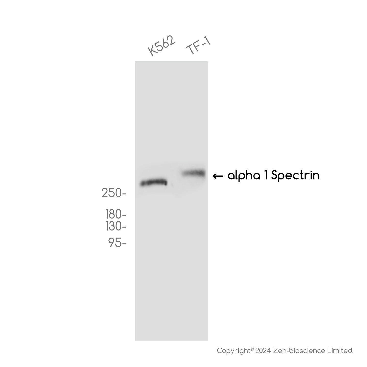 alpha 1 Spectrin Rabbit mAb ABZ3812