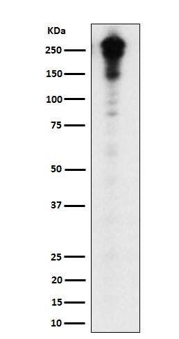 Desmoplakin Rabbit mAb ABZ3815
