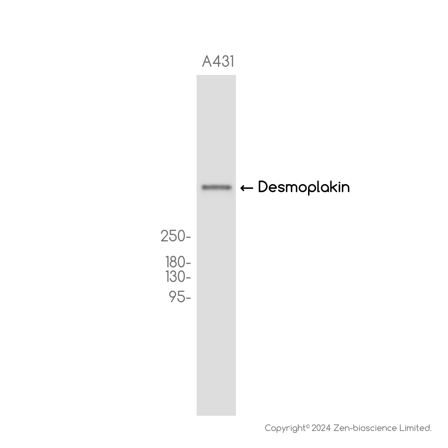 Desmoplakin Rabbit mAb ABZ3815