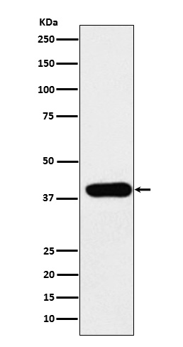 Adenosine Deaminase Rabbit mAb ABZ3816