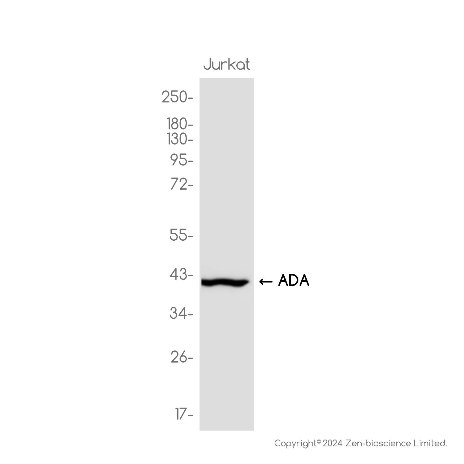 Adenosine Deaminase Rabbit mAb ABZ3816