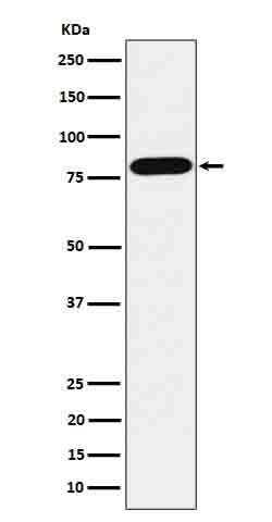 ABCD1/ALD Rabbit mAb  ABZ3819