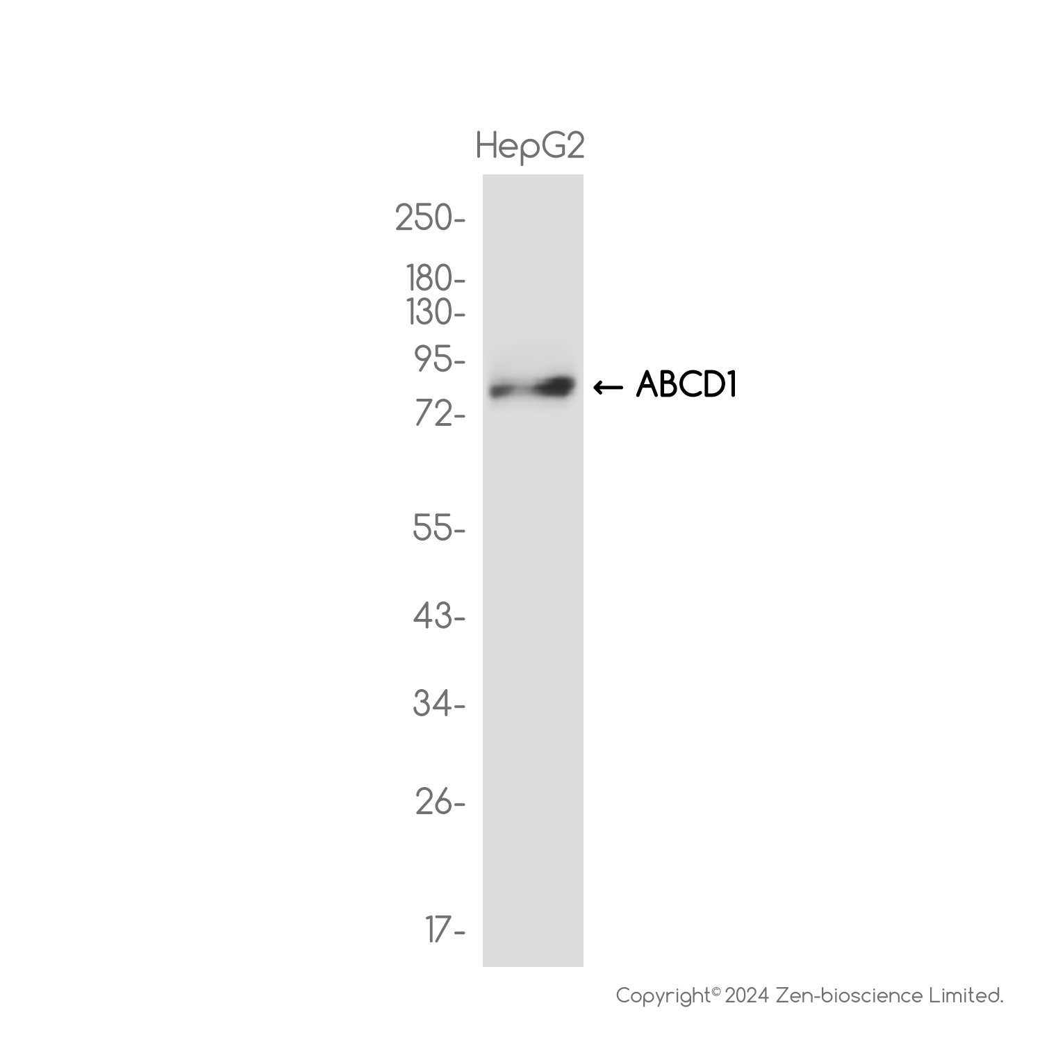 ABCD1/ALD Rabbit mAb  ABZ3819
