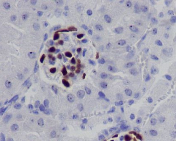 Wilms Tumor Protein Rabbit mAb ABZ3820