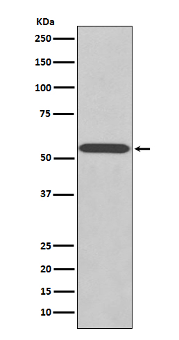 Wilms Tumor Protein Rabbit mAb ABZ3820
