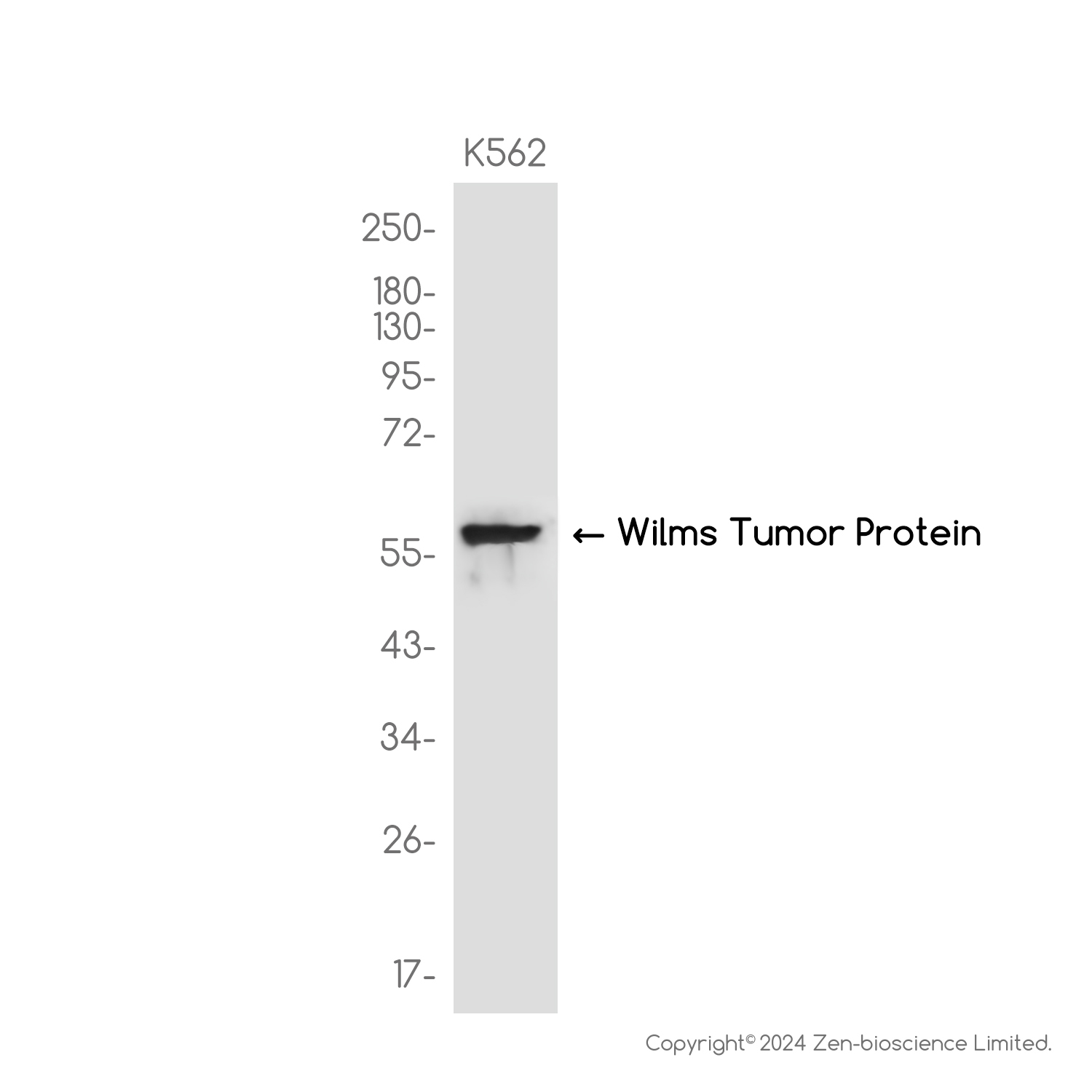 Wilms Tumor Protein Rabbit mAb ABZ3820