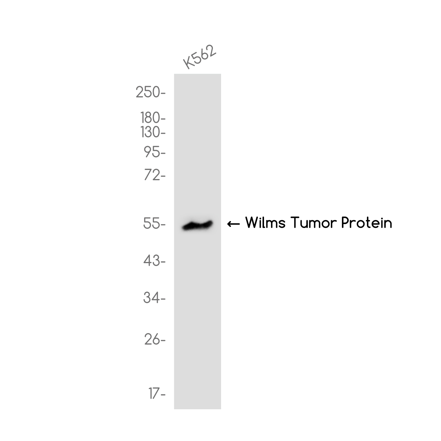 Wilms Tumor Protein Rabbit mAb ABZ3820