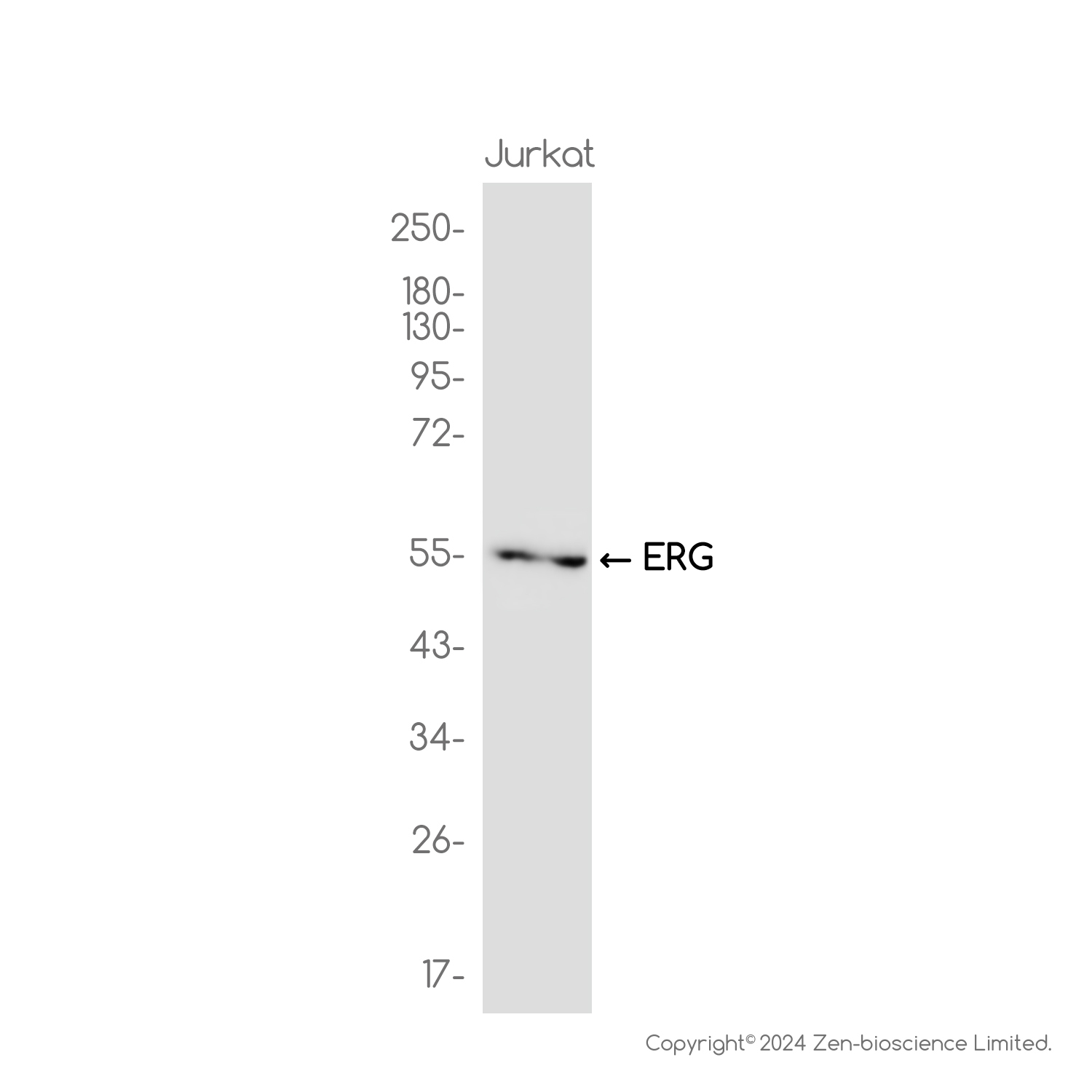 ERG Rabbit mAb ABZ3822