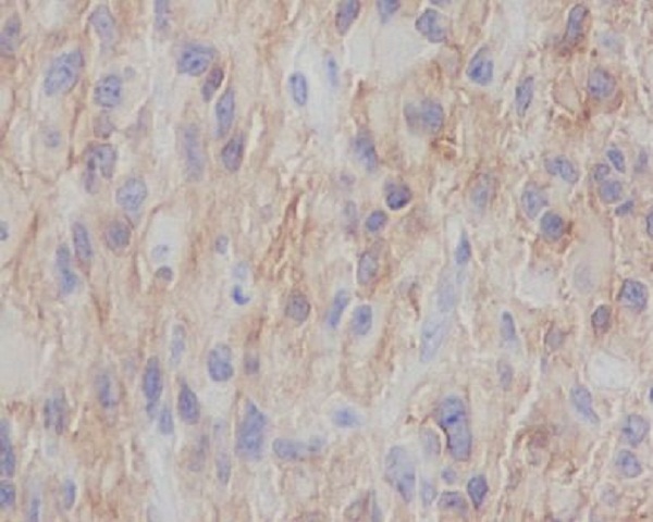 NGFR Rabbit mAb ABZ3823