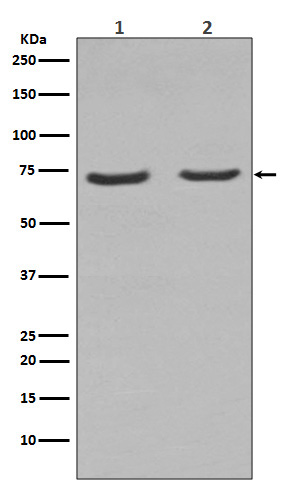 NGFR Rabbit mAb ABZ3823