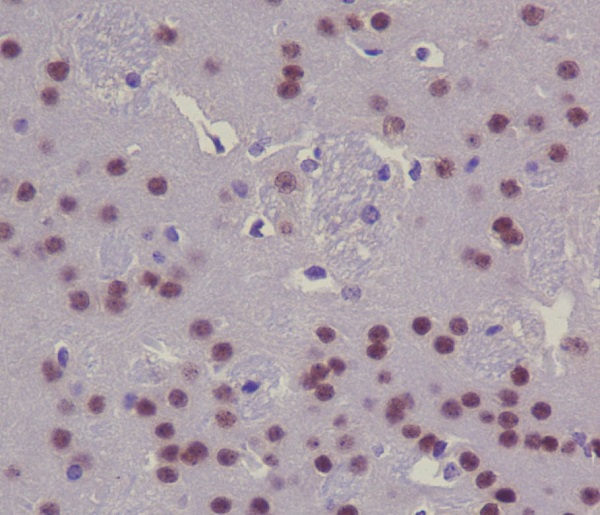 CREB Rabbit mAb ABZ3824
