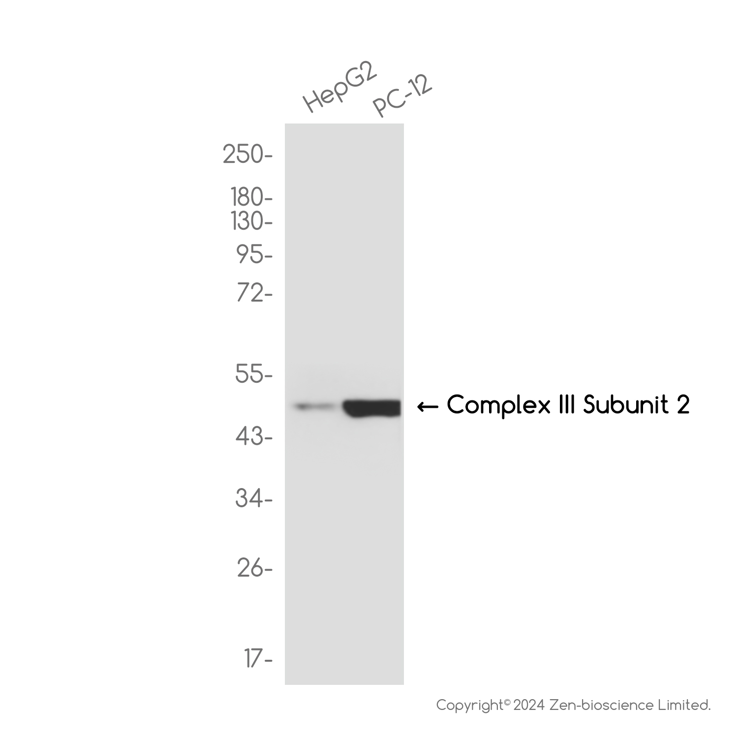 UQCRC2 Rabbit mAb ABZ3825