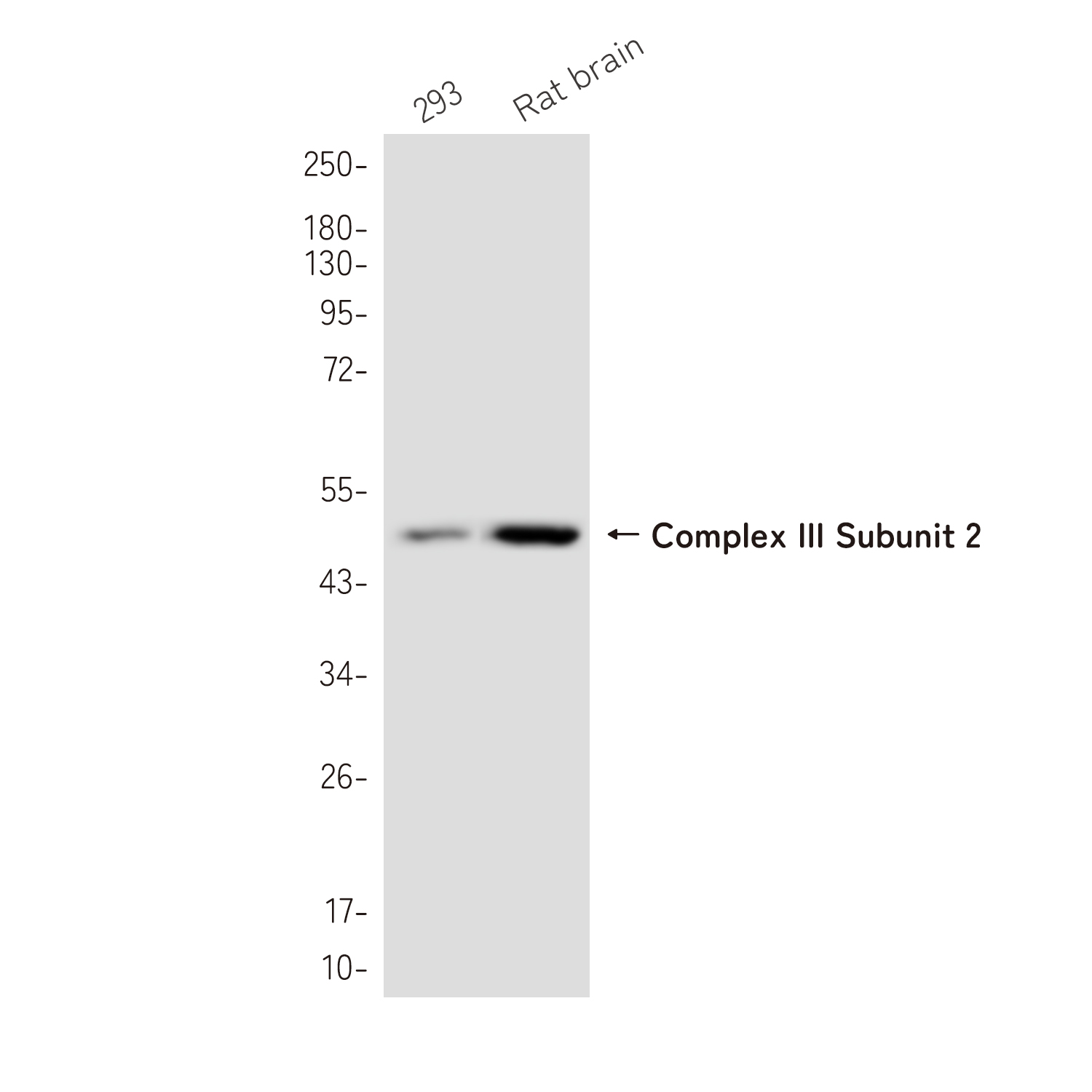 UQCRC2 Rabbit mAb ABZ3825