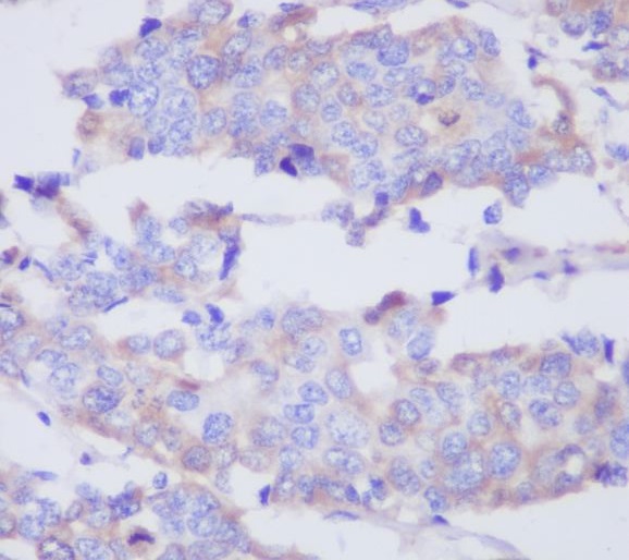 MMP2 Rabbit mAb ABZ3826