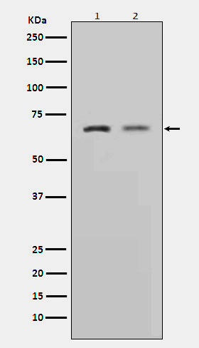 MMP2 Rabbit mAb ABZ3826