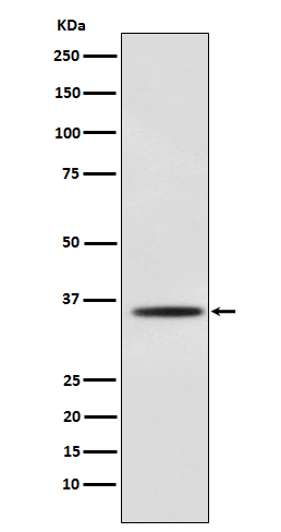 Myogenin Rabbit mAb ABZ3828