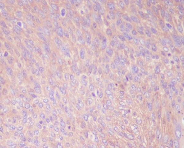PKM2 Rabbit mAb ABZ3829