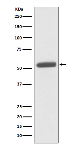 PKM2 Rabbit mAb ABZ3829