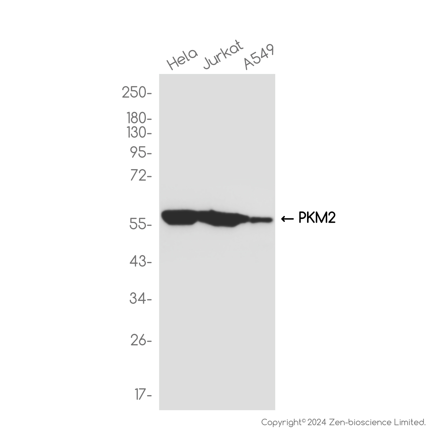 PKM2 Rabbit mAb ABZ3829