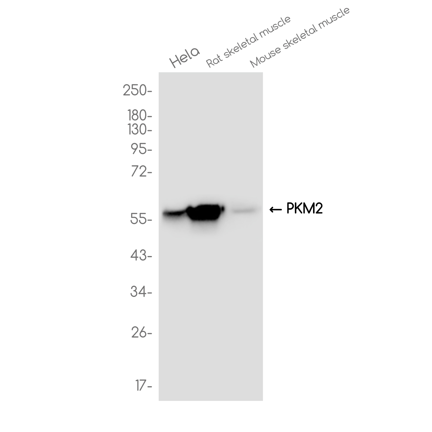 PKM2 Rabbit mAb ABZ3829