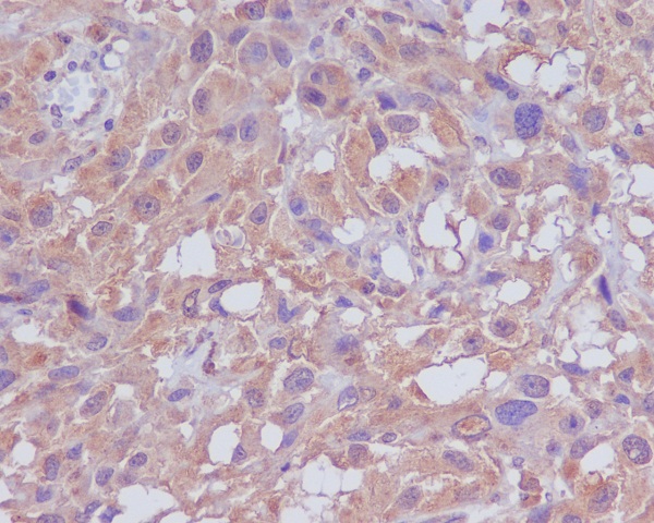 Neuropilin 1 Rabbit mAb ABZ3830