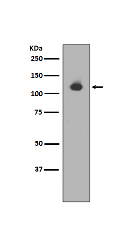 Neuropilin 1 Rabbit mAb ABZ3830