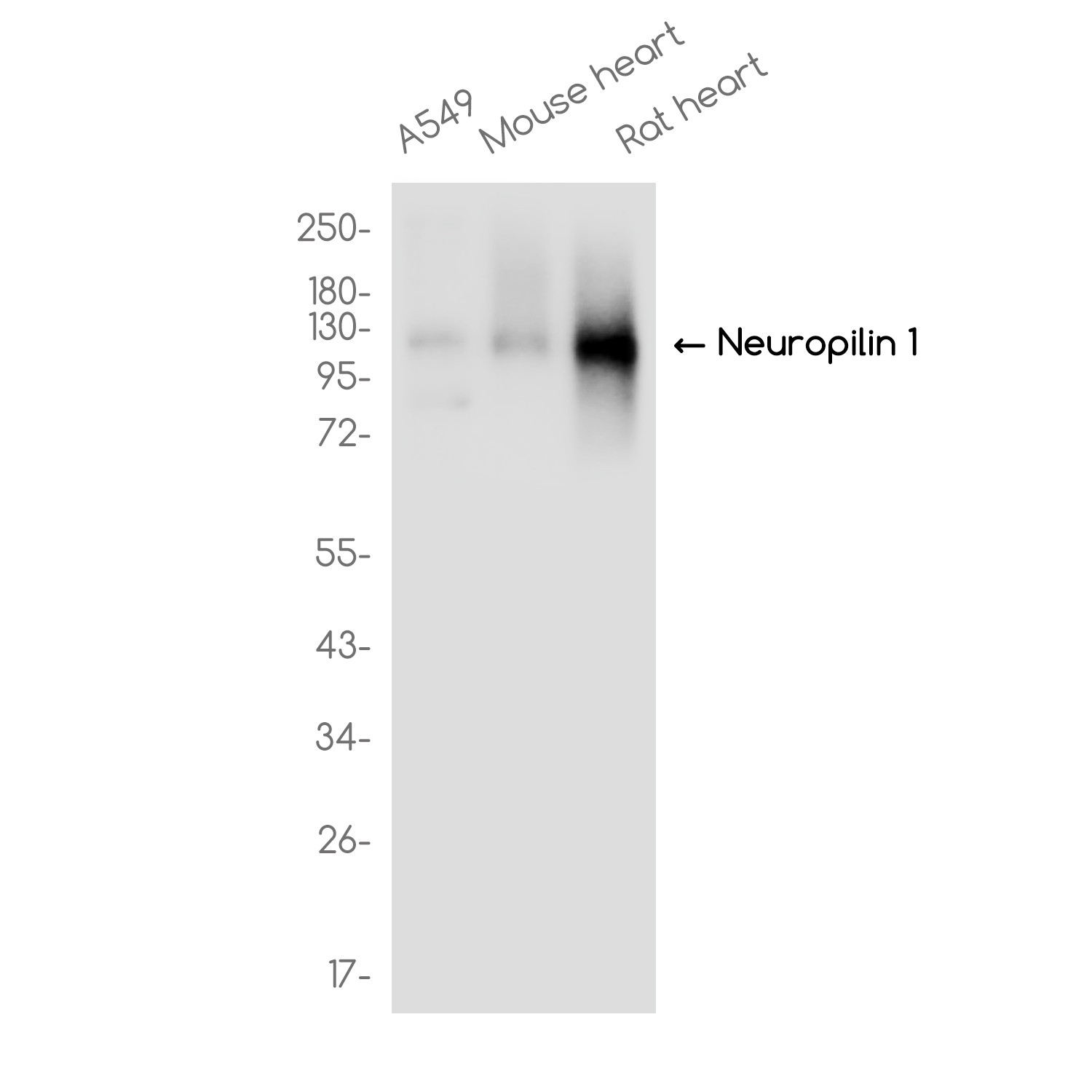 Neuropilin 1 Rabbit mAb ABZ3830