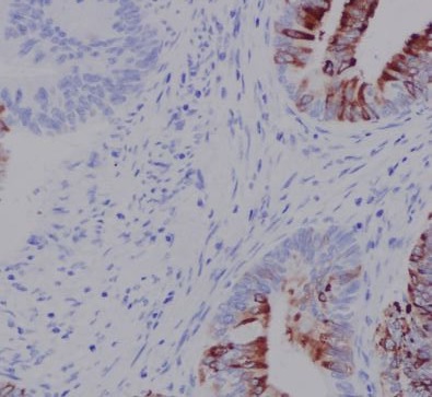 N Cadherin Rabbit mAb ABZ3831