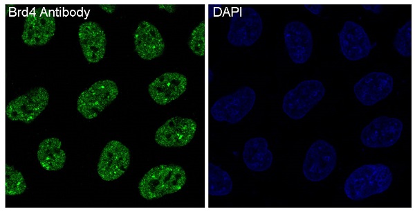Brd4 Rabbit mAb ABZ3832