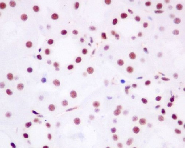 Brd4 Rabbit mAb ABZ3832