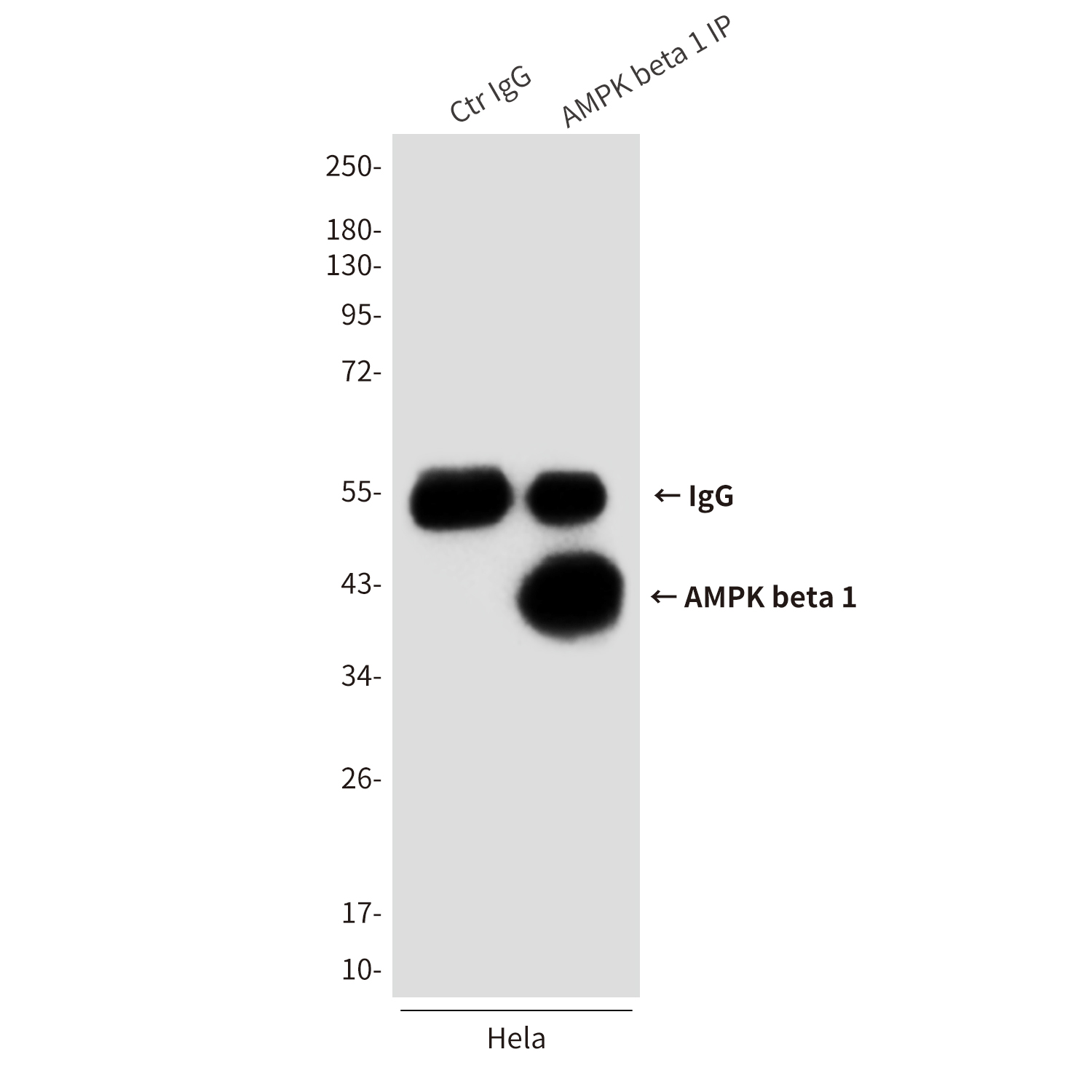 AMPK beta 1 (1A7) Mouse mAb ABZ3833