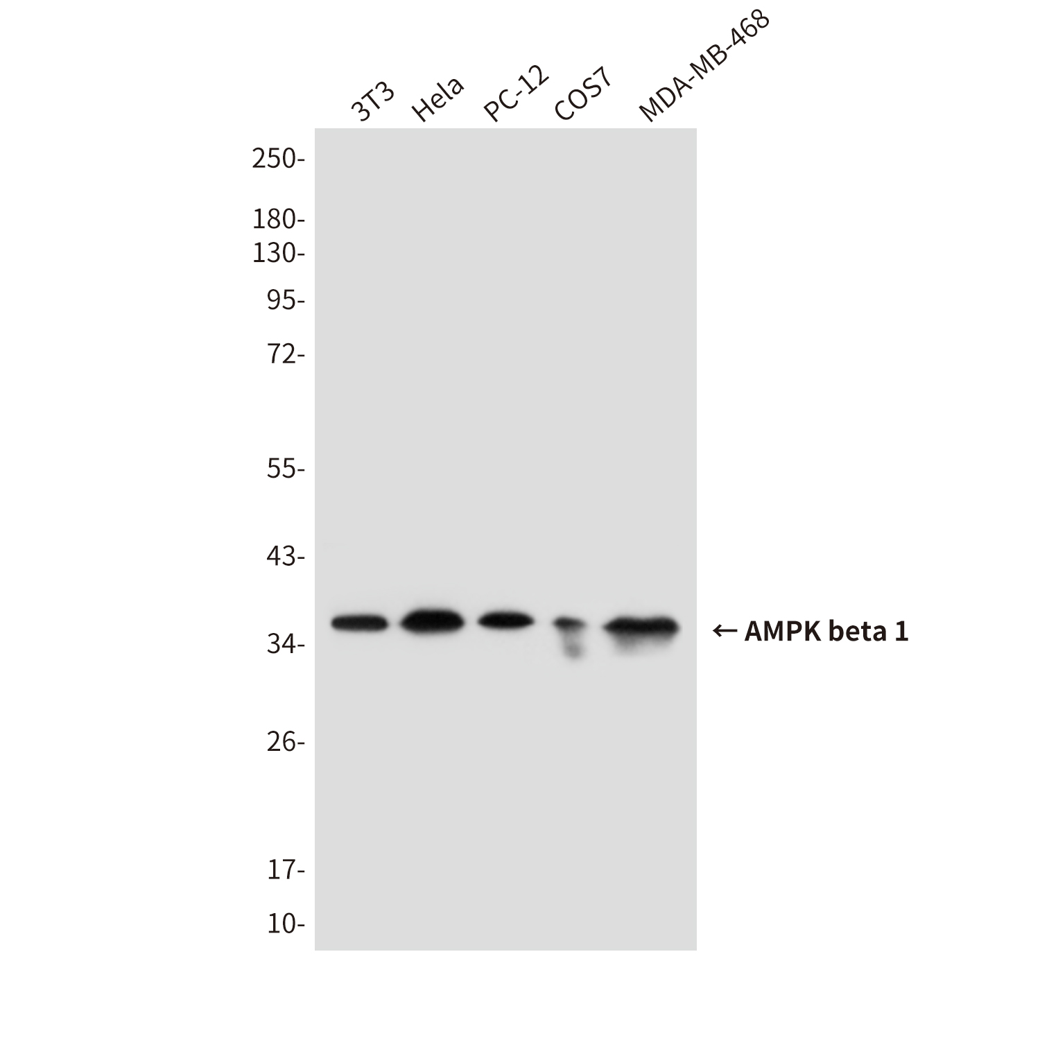 AMPK beta 1 (1A7) Mouse mAb ABZ3833