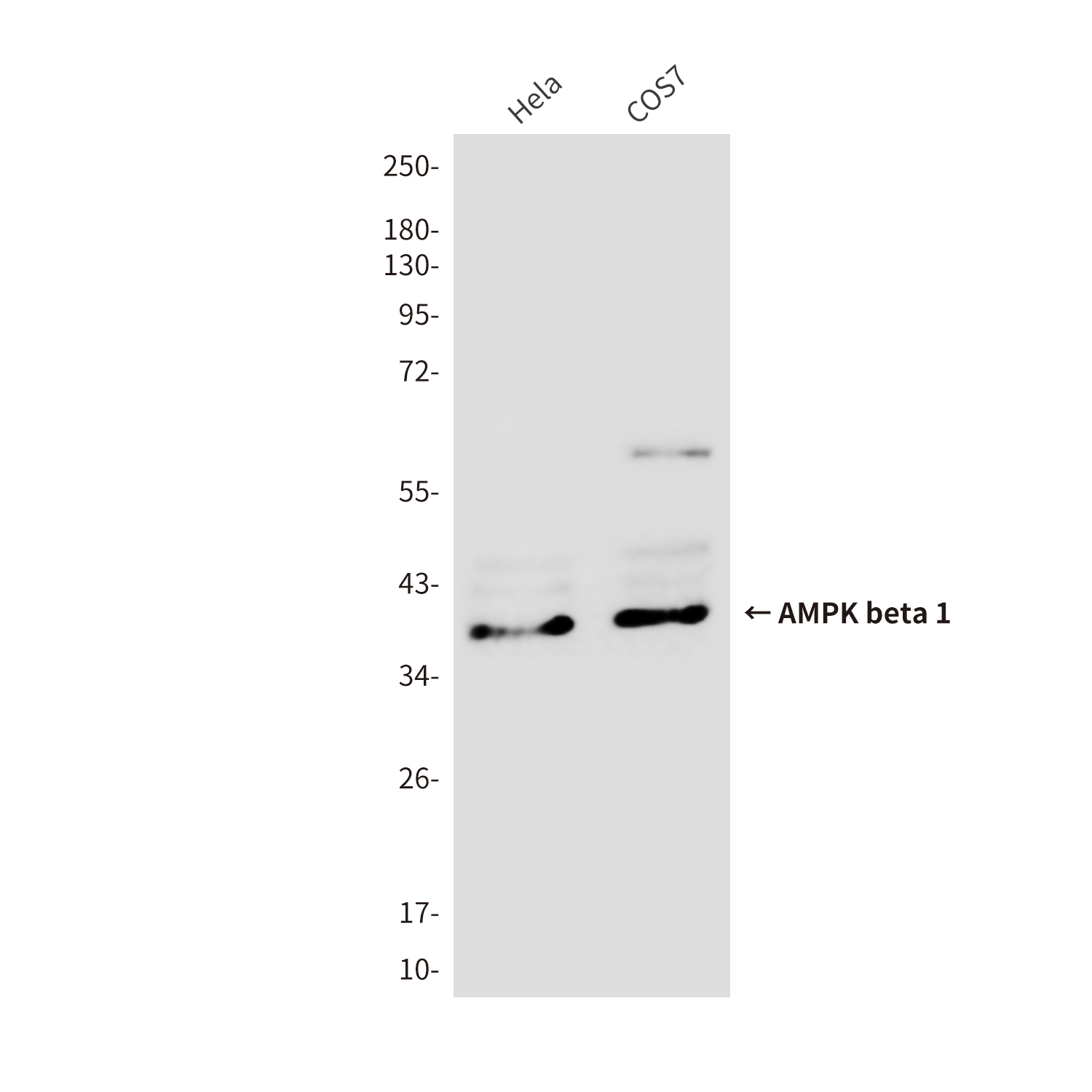 AMPK beta 1 Mouse mAb ABZ3834