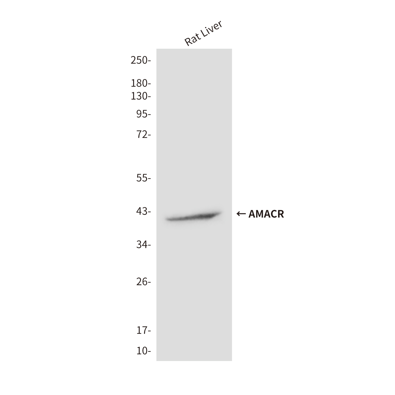 AMACR (2F3) Mouse mAb ABZ3837
