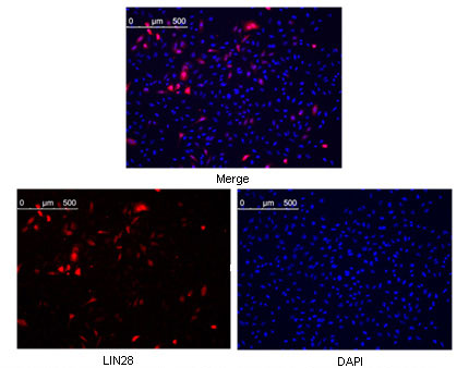Lin28A (9G2) Mouse mAb ABZ3841