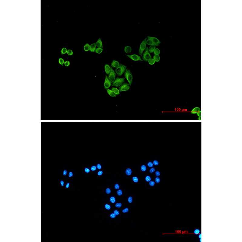 beta I Tubulin (1H10) Mouse mAb ABZ3842