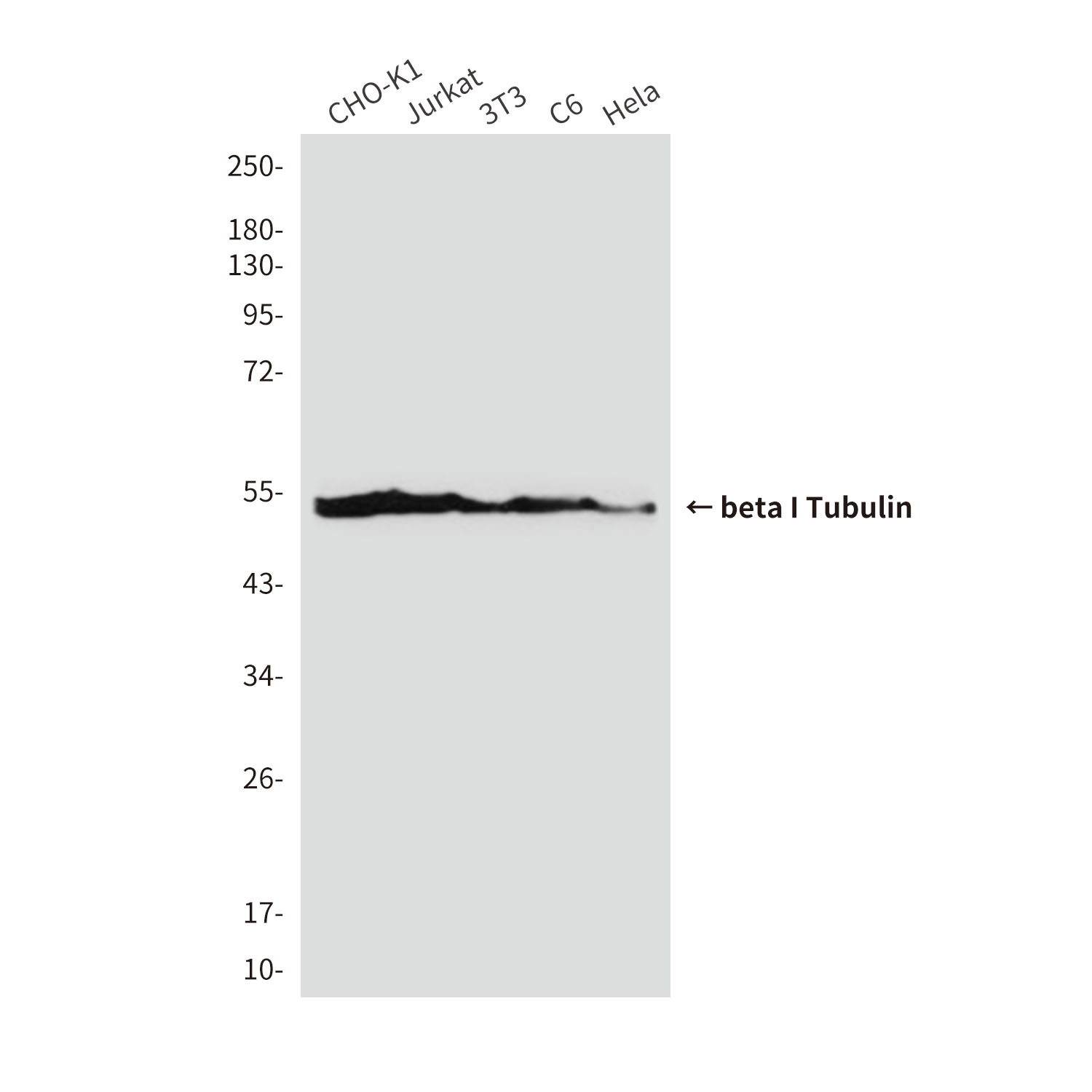 beta I Tubulin (1H10) Mouse mAb ABZ3842