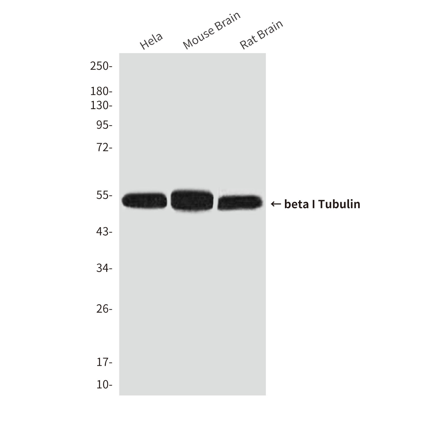 beta I Tubulin (1H10) Mouse mAb ABZ3842