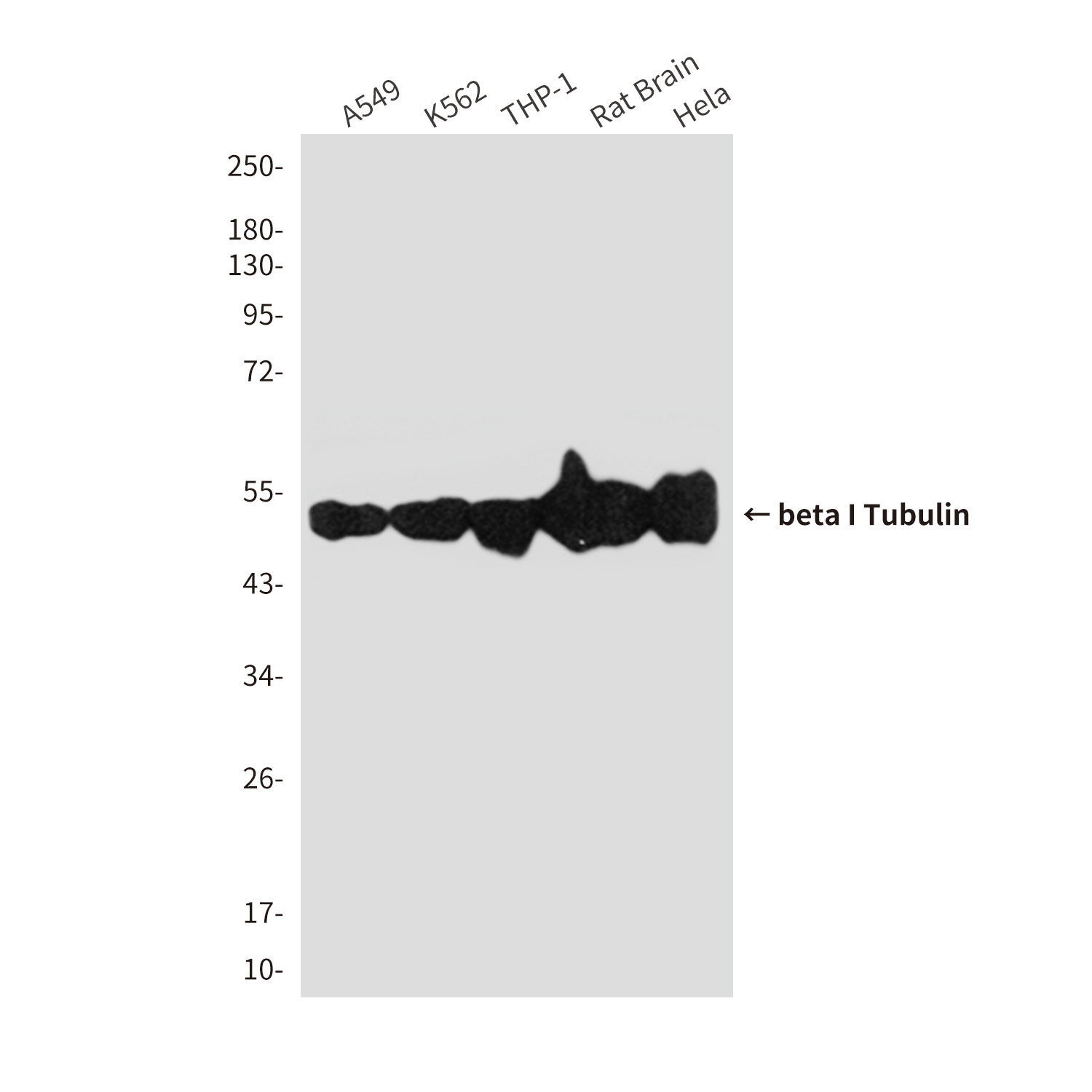 beta I Tubulin (1H10) Mouse mAb ABZ3842