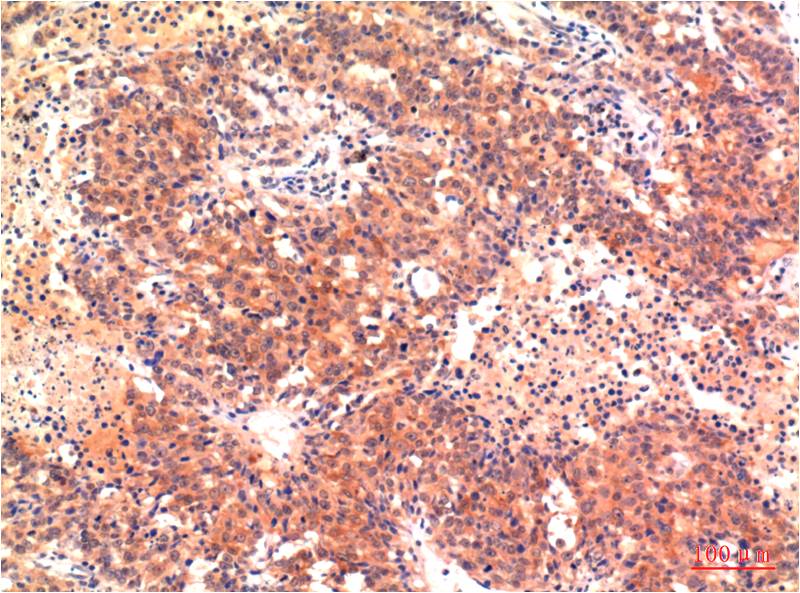 LC3A (8F5) Mouse mAb ABZ3844