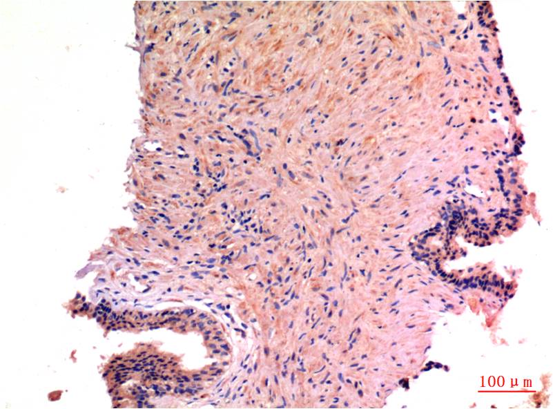 LC3A (8F5) Mouse mAb ABZ3844