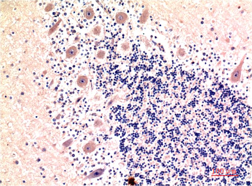 LC3B (8H6) Mouse mAb ABZ3846