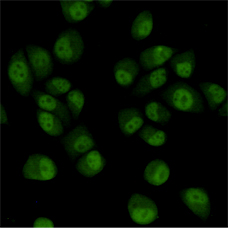 TBLR1/TBL1XR1 (4F3) Mouse mAb ABZ3848