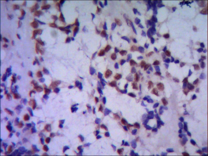 TBLR1/TBL1XR1 (4F3) Mouse mAb ABZ3848