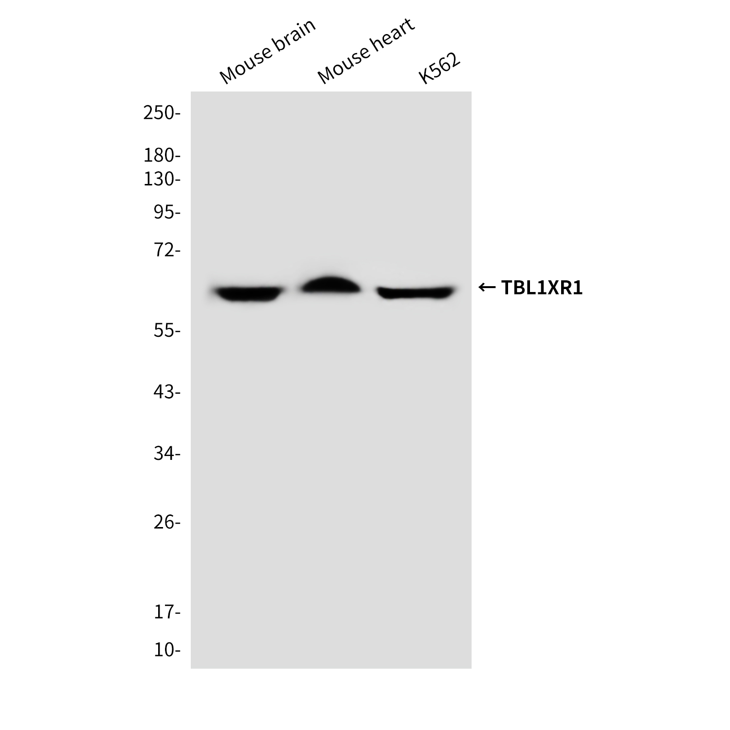 TBLR1/TBL1XR1 (4F3) Mouse mAb ABZ3848