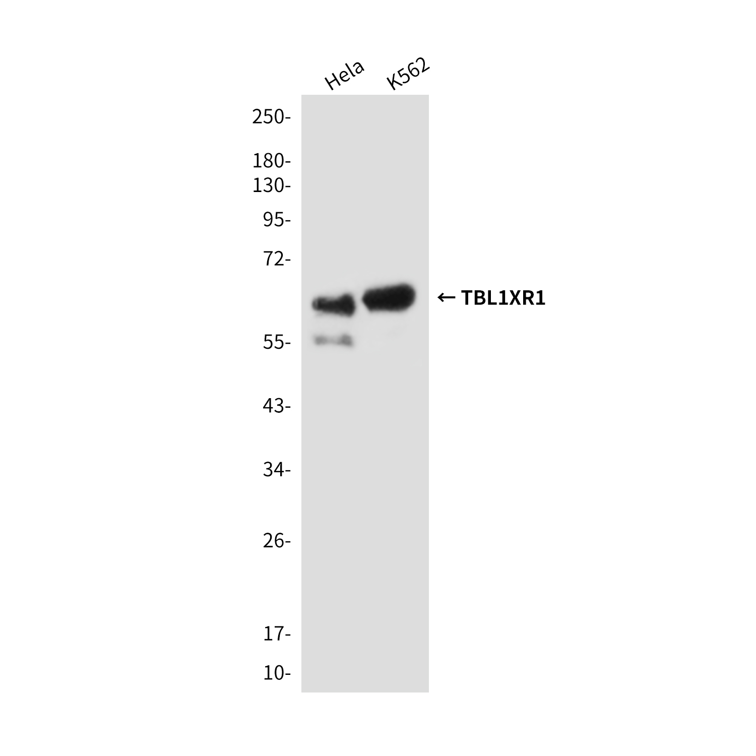 TBLR1/TBL1XR1 (4F3) Mouse mAb ABZ3848