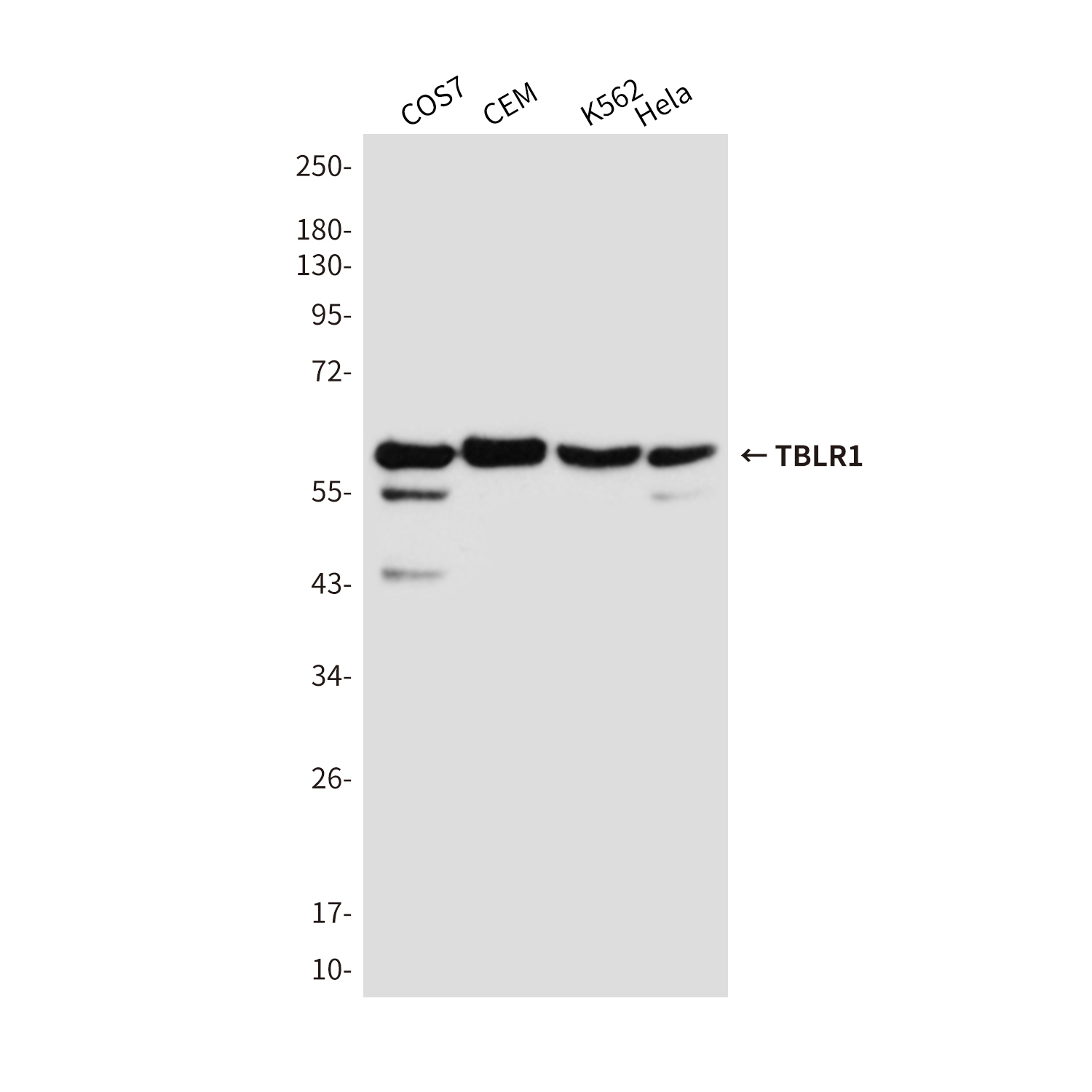 TBLR1/TBL1XR1 Mouse mAb ABZ3849