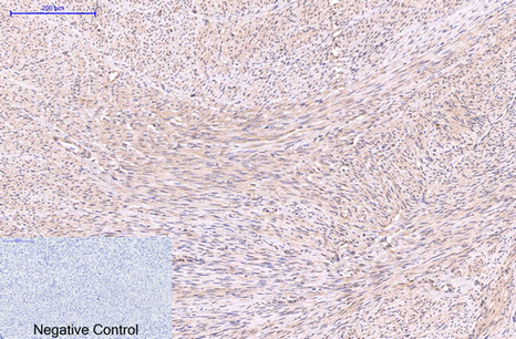 EFHD1 (5C10) Mouse mAb ABZ3850