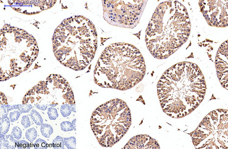 EFHD1 (5C10) Mouse mAb ABZ3850